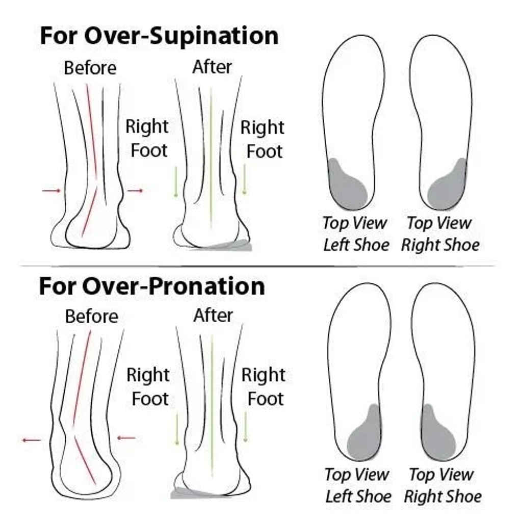 🔥Last Day 49% OFF - Women's Woven Orthopedic Breathable Soft Sole Shoes